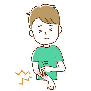 蕁麻疹とは